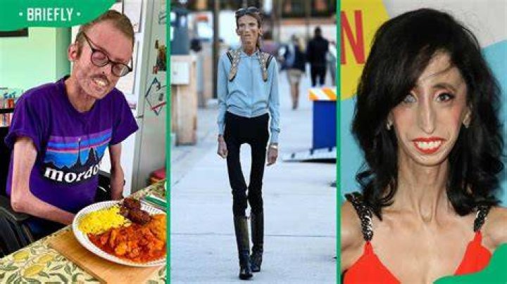 Discovering the Skinniest Person on Earth: Life, Challenges, and Inspiration