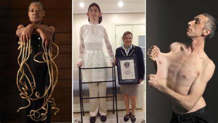 Discovering the World's Skinniest Man: A Fascinating Journey